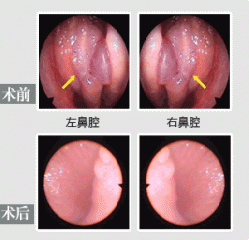 医生妙手还我健康鼻腔