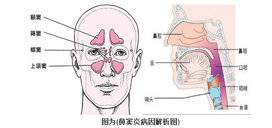 鼻窦炎反复?选对技术轻松搞定_郑州民生耳鼻喉医院