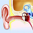 7月大幼儿人工耳蜗植入术在郑州民生耳鼻喉医院成功实施